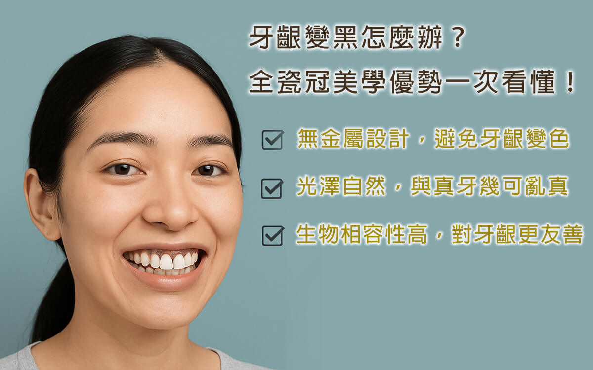 牙齦變黑怎麼辦？全瓷冠美學優勢，告別假牙黑邊困擾！